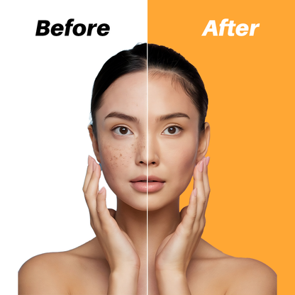 Soviqe Vitamin C Face Serum 30ml